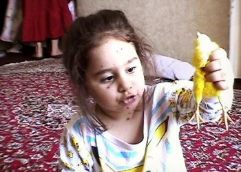 بیماری آبله مرغان